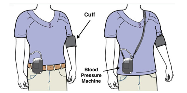 Ambulatory Blood Pressure Monitor
